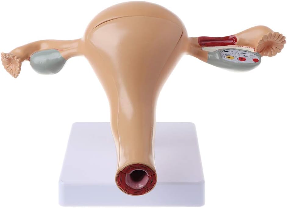 WHER Human Pathological Uterus Ovary Model Anatomical Anatomy Disease Pathology Medical Lesion for Teaching