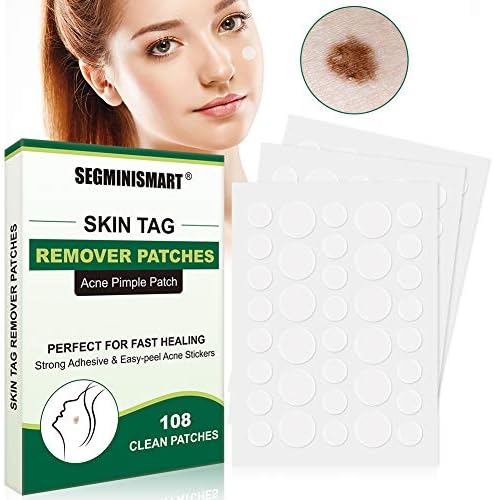 mole and skin tag remover