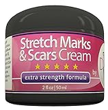 Diva Fit & Sexy Stretch Mark and Scar Removal Cream, 2 fl. oz.