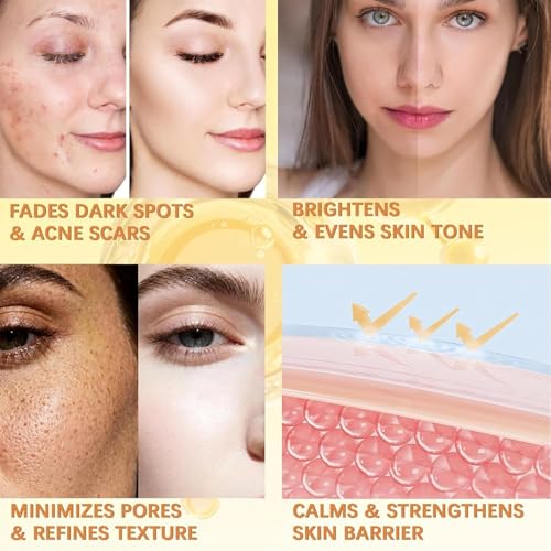 Body Keratin Care Kojic Acid Turmeric Spray Gently Exfoliating Peeling Solution Skincare with Retinol, Glutathione, Niacinamide, Vitamin B, C, E for All Skin Types 200ml