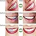 45g Steel Box Teeth Whitening Cleaning Teeth- Charcoal Powder Natural Teeth Whitening (Style D Bottokan)