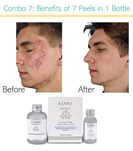 Azarvi Combo 7 Peel Including After Peel Neutralizer. Includes: 15% TCA, Salicylic Acid, Glycolic Acid, Lactic Acid, Mandelic Acid, Vitamin C and Resorcinol