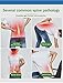 Jimugor Back Stretcher Device - Lower Back Pain Relief, Lumbar Stretching Treatment，Spinal Stenosis - Posture Corrector - Back Support for Office Chair(White/Blue)