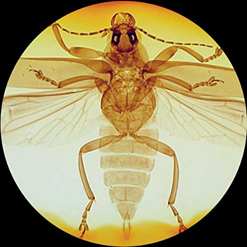 AmScope-AWARDED-2016-BEST-STUDENT-MICROSCOPE-40X-1000X-Dual-Light-Glass-Lens-Metal-Body-Student-Microscope-with-Slides-Tools-and-Book