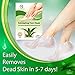 NEW 2018 Exfoliating Foot Peel Mask For Soft Smooth Touch Baby Feet - 2 Pairs Peeling Away Calluses Dead Skin Remover for Feet - Repair Rough Heels - Aloe Baby Foot Peel