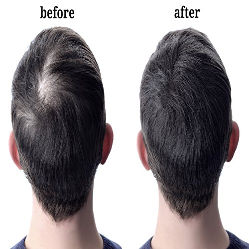 image for Leka HairCare Leka Hair Fibers - Best Keratin Hair Fibers Instantly Th