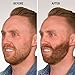 ECLIPSE Hair Fibers Medium Brown for Thinning Hair for Women & Men to Conceal Hair Loss in 15 Seconds - 100% Undetectable Hair Building Fibers, 15g