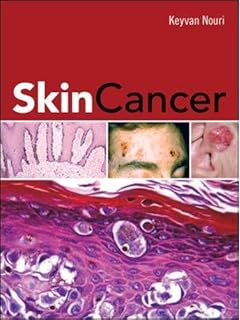 The Challenge Of Dermato Epidemiology 9780849376894 - 