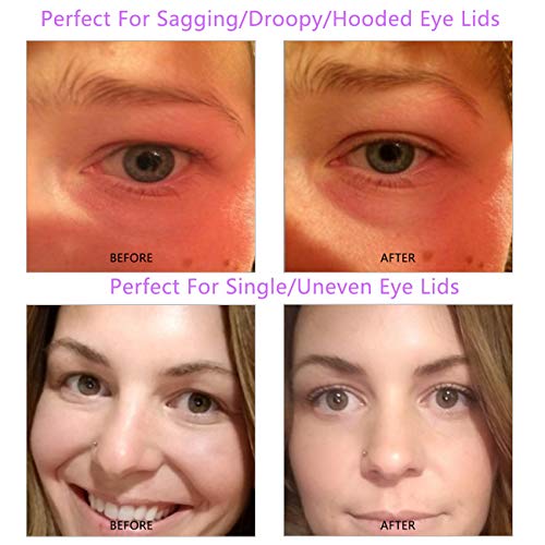Enlarge Eyes, 3D Eye Lids Lift Strip for Saggy Droopy Hooded Eyelids, Natural Invisible Slim One-sided Double Eyelid Tape, Imported Self-adhesive Medical Fibre, Instantly Eyelids Lift Without Surgery