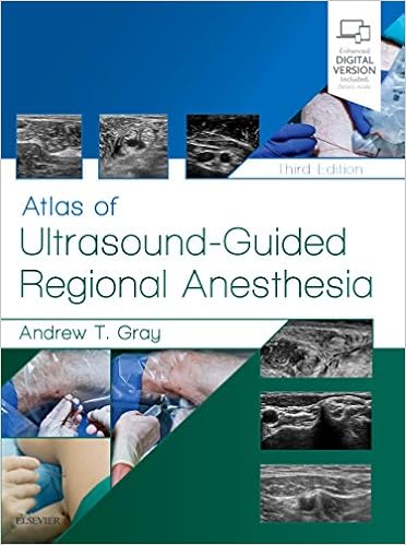 Atlas Of Ultrasound Guided Regional Anesthesia Expert Consult Online And Print 9780323509510 Medicine Health Science Books Amazon Com