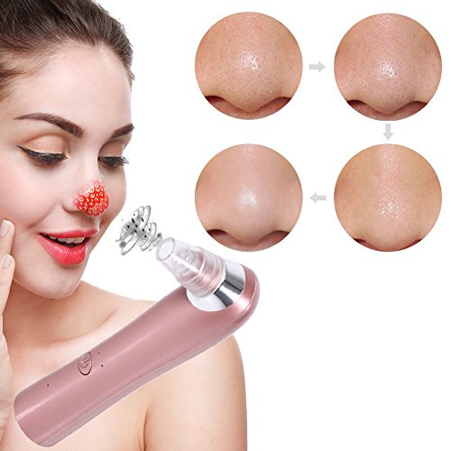 Blackhead Suction Machine, Nose Acne Remover Utilizes Vacuum Extraction Tool Skin Care Tightening Facial Beauty Salon Device Instrument (Rose Gold)