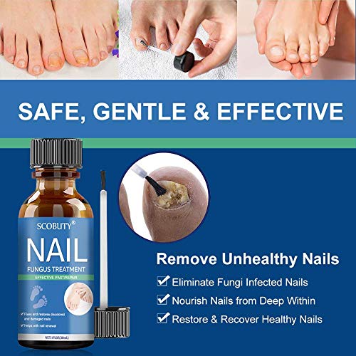Fungus Nail Treatment,Nail Fungus Treatment for Toenail,Nail Repair,Toe
