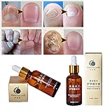 Mchoice Nail Treatment Essence Nail and Foot Whitening Toe Nail Fungus Removal