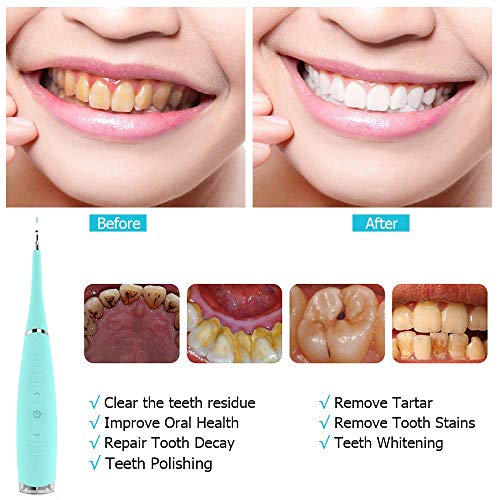 Electric Dental Calculus Remover, HighFrequency Vibration Tartar Scraper Tartar Remover for