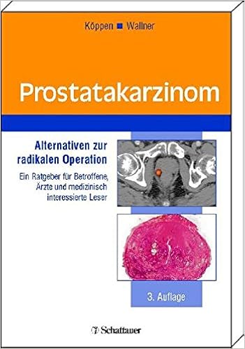 Prostatakarzinom Alternativen Zur Radikalen Operation Ein Ratgeber Fur Betroffene Arzte Und Medizinisch Interessierte Leser Amazon De Koppen Ulrich Wallner Kent Bucher