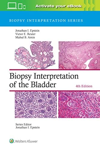 Muscle Biopsy: A Practical Approach: 9780702074714: Medicine