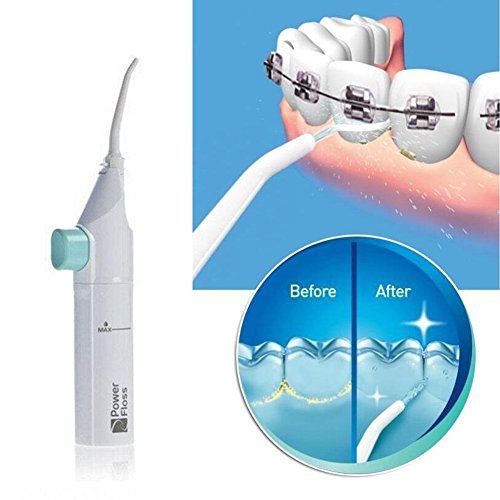 Portable Power Floss Dental Oral Water Jet Teeth Flusher Tooth Care Irrigator Cleaning Flosser