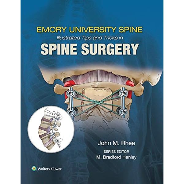 Amazon.com: Orthopaedic Knowledge Update® Spine 6 (AAOS