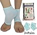 Moisturizing Socks for Women & Men | Cracked Heel Treatment with Aloe Vera | Moisturizer Foot Callus Remover | Aloe Socks for Cracked Heels & Dry Rough Feet, Lotion Infused Gel Heel Sleeves Fits Most