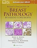Rosen's Diagnosis of Breast Pathology by Needle Core Biopsy by Syed A. Hoda MD, Paul Peter Rosen MD