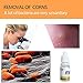 Onkessy Skin Tag Remover Mole Removal Warts Remover, 10mlthumb 4