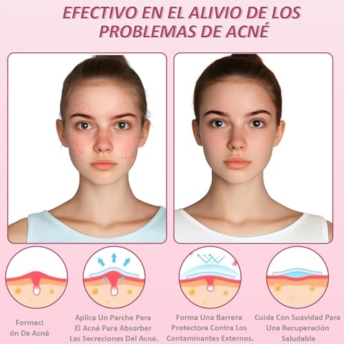 SYCHUNQI 96 Estrellas para Granos, 3 Cajas de Parches para Acne con Espejos | para Cubrir Acné e Imperfecciones, Pimple Reduce Enrojecimiento, para Fiestas y Uso Diario