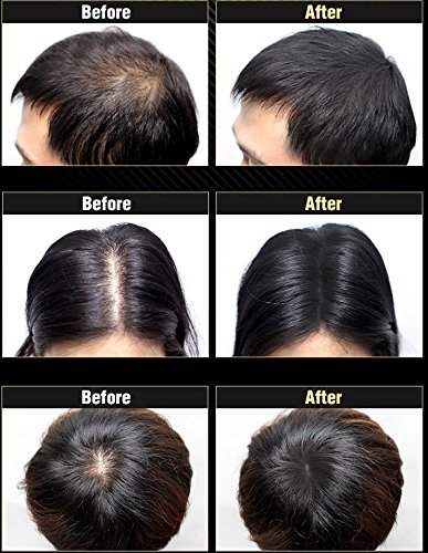 DASHU Anti-Hair Loss Hair Cushion Hair Concealer Hair Building Fibers Black / Dark Brown / Light Brown (26g, Light Brown)