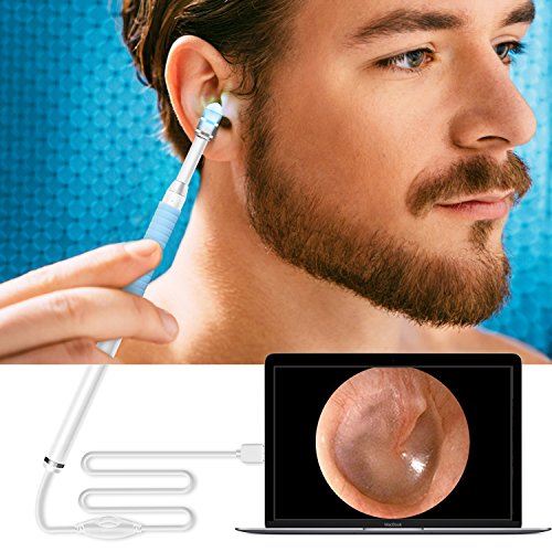Ear Otoscope,TryAce 1.3MP 720P HD Ear Scope Inspection Camera 3 In 1 USB Ear Digital Endoscope Earwax Cleansing Tool with 6 Leds for Micro USB,USB-C Android Phone,Windows MAC PC - Thumbnail 5