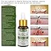 Hair Growth Serum, Anti-Hair Loss Serum, Hair Regrowth Oil, Stops Hair Loss, For Thinning Hair, Alopecia Areata, Promotes Thicker, Fuller ＆ Faster Growingthumb 4
