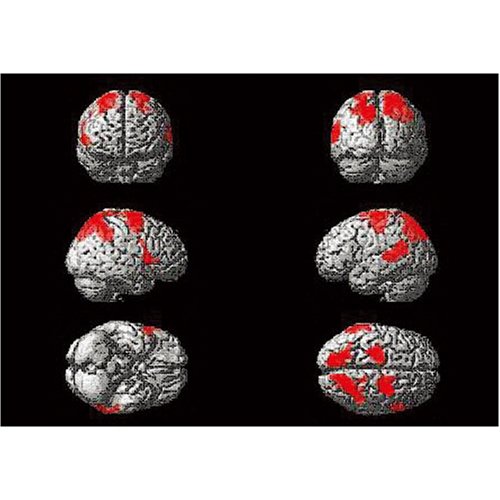 コーディネーショントレーニング Part1 小学生編 Dvd 東根 明人 日本コーディネーショントレーニング協会 本 通販 Amazon