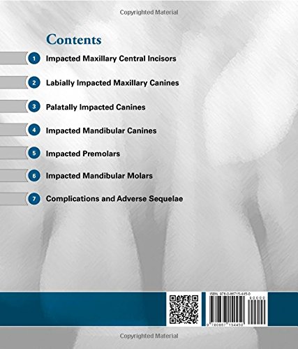 Orthodontic and Surgical Management of Impacted Teeth