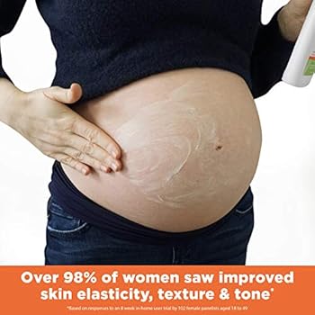 palmers belly lotion