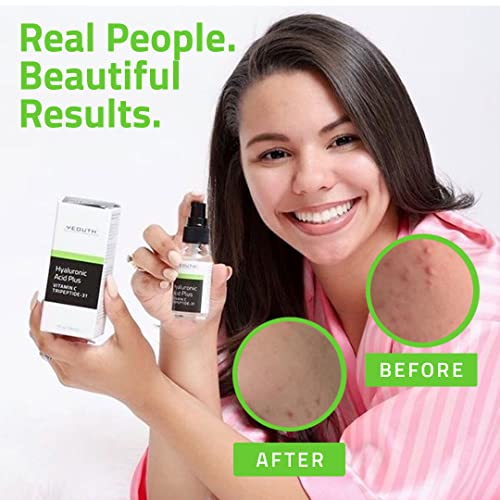 Hyaluronic Acid Serum for Face with Vitamin C, Hydrating Serum, Anti