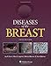 Diseases of the Breast 5e by