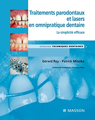 Traitements parodontaux et lasers en omnipratique dentaire : La simplicité efficace by Patrick Missika, Gérard Rey