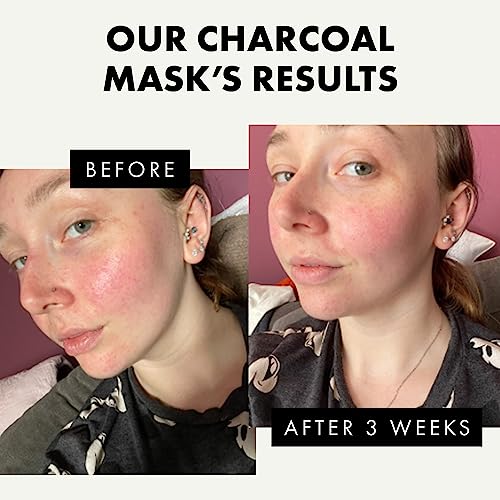 DETOXIFYING CHARCOAL BLACKHEAD PEEL OFF FACE MASK – BLACK HEAD REMOVER MASK FOR FACE WITH KAOLIN+BENTONITE CLAY, ORGANIC BLACKHEAD REMOVAL FACE MASKS, SKINCARE FACE CARE KIT PORE MASK, BLACKHEAD EXTRA