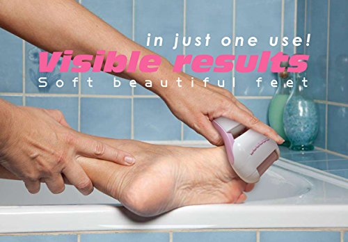 Electric Callus Remover - PRITECH Electronic Pedicure Tools, Professional Wet and Dry Rechargeable Foot File Removes Dead, Hard, Cracked Skin With Fine & Rough Roller and Protective Cover - Thumbnail 5