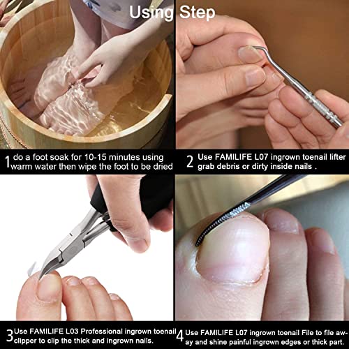 FAMILIFE Ingrown Toenail File and Lifter, 2pcs Ingrown Toenail Tool