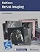 Breast Imaging (RadCases)