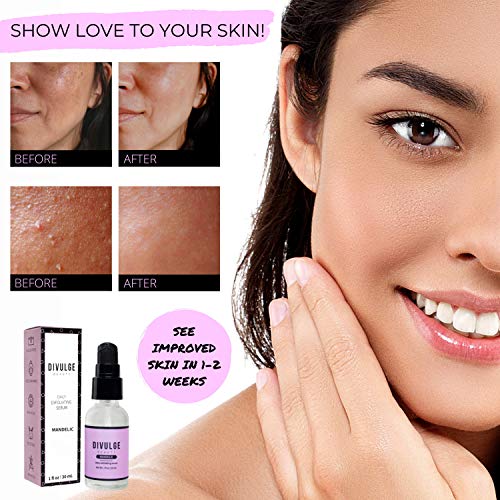 AHA Mandelic Acid Gel Daily Exfoliating Acne Scar Treatment Serum for