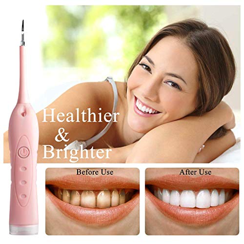Electric Dental Calculus Plaque Remover Tool Kit, High-Frequency Vibration Tartar Scraper Remover for Dental Calculus, Tooth Stains, Plaque Removal, 3 Adjustable Modes (Pink)