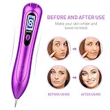Mole Remover Pen, COOFO Professional Removal Pen Skin Tag Remover with LCD Display & 8 Strength Levels for Body Facial Freckle Nevus Warts Age Spot Tattoo Remover Machine