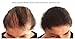 Boost N Blend Scalp Concealer, Hair Powder, Female Hair Fibers for Thinning Hair & Visible Scalp - Hair Volumizer for Women (25g/0.88oz) – The Only Female Cotton Hair Fiber