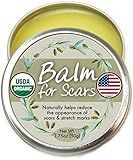 Organic Scar Fade Balm - Natural, Made in USA, USDA Certified Scar Fade Salve to Moisturize, Protect, Heal Skin. Surgery Scars, Stretch marks, Acne Spots, etc.