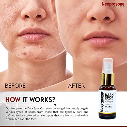 NEOPROSONE, Dark Spot Remover for Face 1 Fl oz / 30 ml