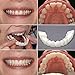 Oldeagle 5PCs Cosmetic Teeth, Temporary Smile Comfort Fit Cosmetic Teeth Denture Teeth Top Cosmetic Sticker For Men, Women