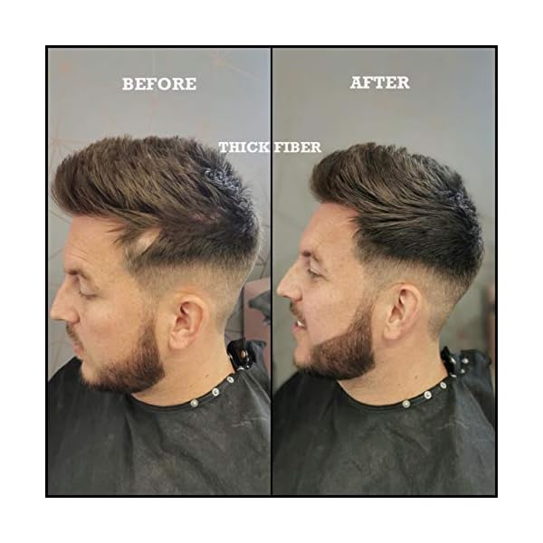 THICK FIBER Hair Fibres (Pack of 1 DARK BROWN) | Hair Powder for Thinning Hair 25g Bottle | Makes Thin Hair Look Thicker…