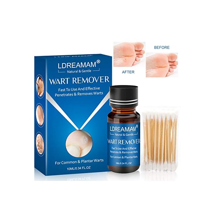 Wart Remover,Foot Wart Remover,Plantar Wart Remover,Wart Liquid,Painlessly Removes Common and Plantar Warts