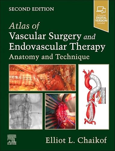 Amazon.com: Echocardiographic Anatomy in the Fetus eBook : Chiappa