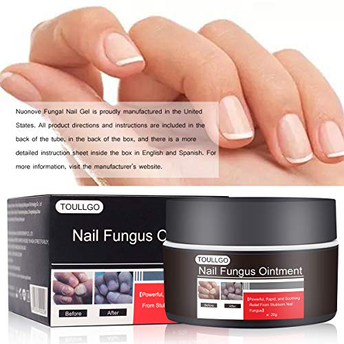 Nail Repair Solution, Nail Treatment, Onychomycosis Treatment, Onychomycosis Cream, Fingernails Repair, Effective Personal Care Supply, 20g